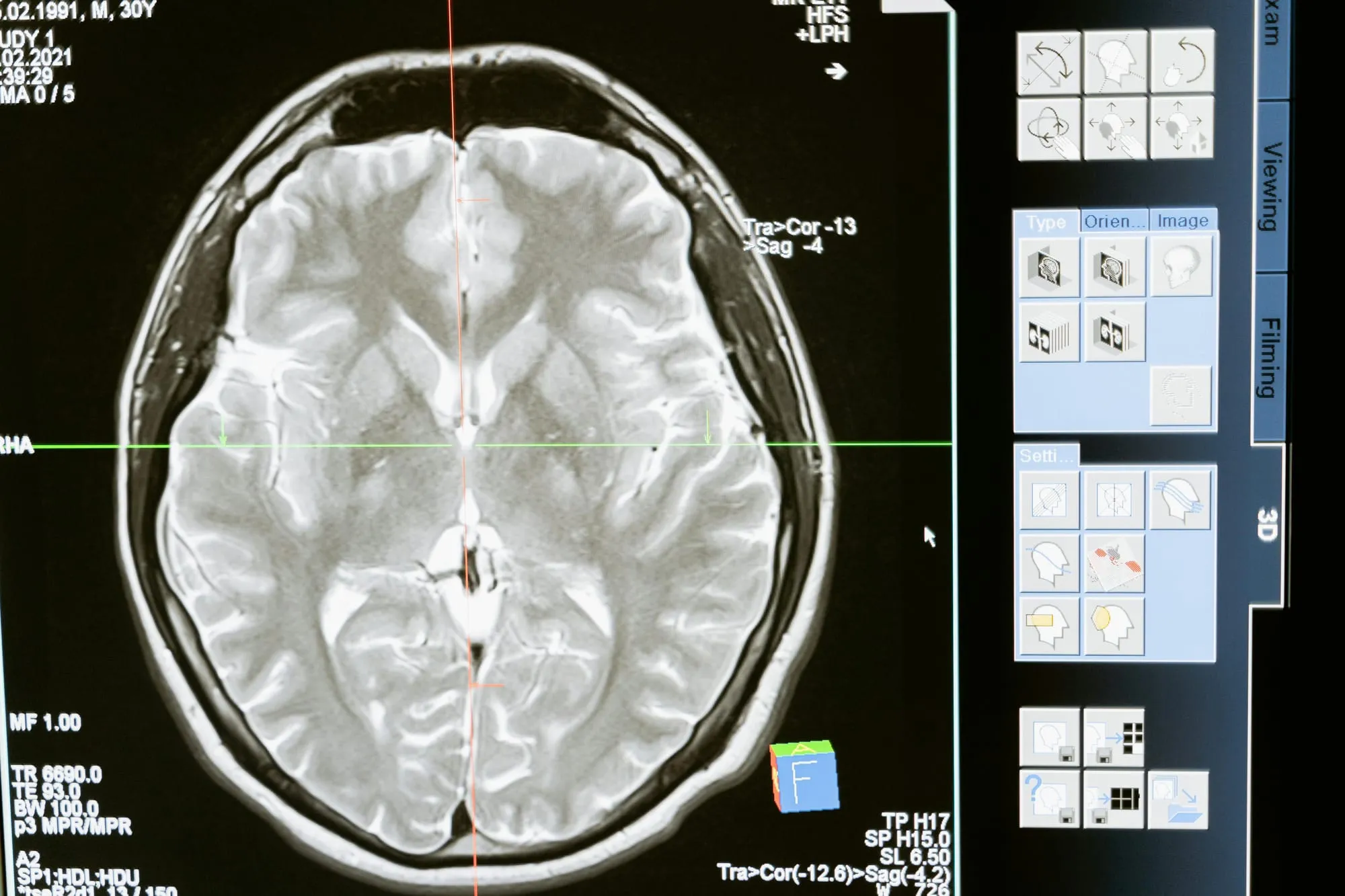 The Default Mode Network: the neural substrate of the inner conversation